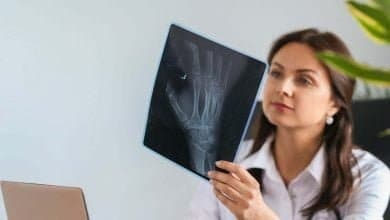 c&aacute;ncer en los huesos