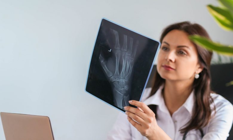 cáncer en los huesos