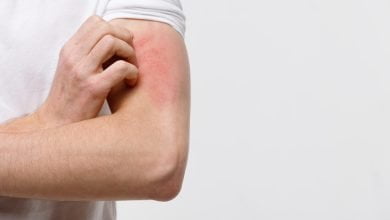 macho rascarse la picaz&oacute;n en la mano, aislado sobre fondo gris dermatitis